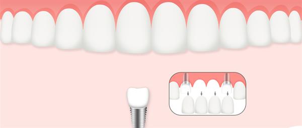 濟(jì)南口腔醫(yī)學(xué)專業(yè)學(xué)校是什么層次的學(xué)校？學(xué)校怎么樣？