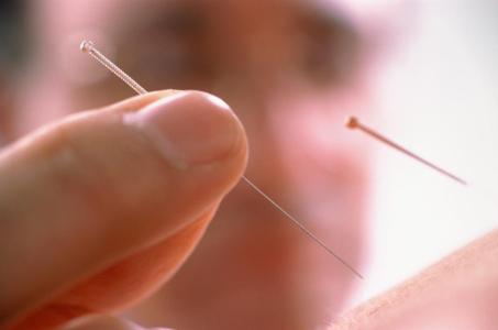 石家莊炎黃針灸推拿學(xué)校：針灸推拿有哪些好處？